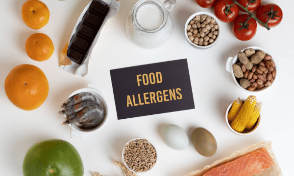 What Is the allergen information for loose foods?