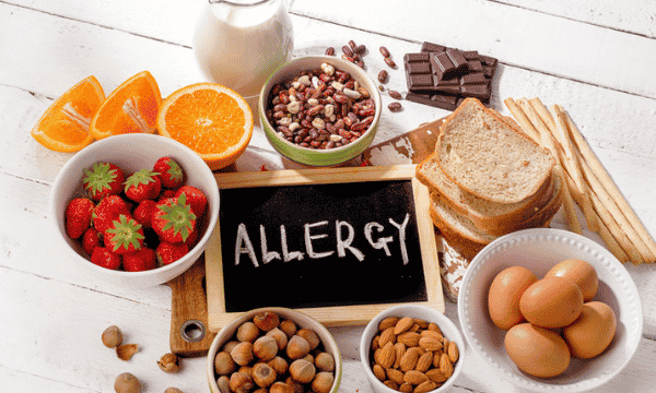 What is an Allergy
